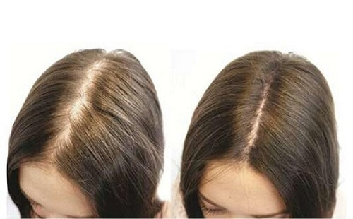 Tinh chất hà thủ ô không những giúp đen tóc mà còn kích thích mọc tóc cực hiệu quả